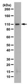 Anti-MCPH1 Antibody from rabbit, purified by affinity chromatography