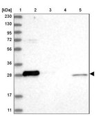 抗-BCL2L1 兔抗 Prestige Antibodies® Powered by Atlas Antibodies, affinity isolated antibody, buffered aqueous glycerol solution