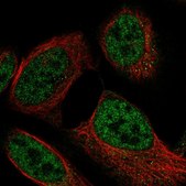Anti-MLST8 antibody produced in rabbit Prestige Antibodies® Powered by Atlas Antibodies, affinity isolated antibody, buffered aqueous glycerol solution