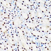 Anti-PBRM1 antibody produced in rabbit