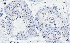 Anti-Androgen Receptor Antibody, clone 3K11 , ZooMAb® Rabbit Monoclonal recombinant, expressed in HEK 293 cells