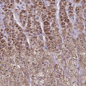 Anti-CYP11B2 antibody produced in rabbit Prestige Antibodies® Powered by Atlas Antibodies, affinity isolated antibody, buffered aqueous glycerol solution