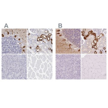 Anti-CALB1 antibody produced in rabbit Prestige Antibodies® Powered by Atlas Antibodies, affinity isolated antibody, buffered aqueous glycerol solution