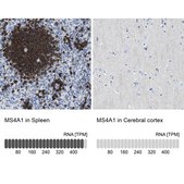 Anti-MS4A1 antibody produced in rabbit Prestige Antibodies® Powered by Atlas Antibodies, affinity isolated antibody, buffered aqueous glycerol solution