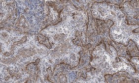 Anti-Integrin αVβ5 Antibody, clone EM09902 , ZooMAb® Rabbit Monoclonal recombinant, expressed in HEK 293 cells
