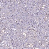 Anti-ADH1A antibody produced in rabbit Prestige Antibodies® Powered by Atlas Antibodies, affinity isolated antibody, buffered aqueous glycerol solution