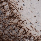 Monoclonal Anti-MBP antibody produced in mouse Prestige Antibodies® Powered by Atlas Antibodies, clone CL2819, purified immunoglobulin, buffered aqueous glycerol solution