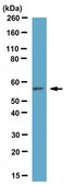 Anti-Calcineurin Aβ Antibody from rabbit, purified by affinity chromatography