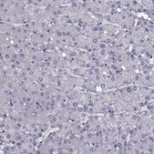 ANTI-MAGEB1 antibody produced in rabbit Ab2, Prestige Antibodies® Powered by Atlas Antibodies, affinity isolated antibody, buffered aqueous glycerol solution