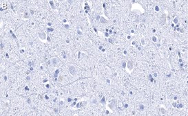 Anti-Histone H2B Antibody, clone 4O11 ZooMAb® Rabbit Monoclonal recombinant, expressed in HEK 293 cells
