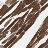 Anti-CACNA2D1 antibody produced in rabbit Prestige Antibodies® Powered by Atlas Antibodies, affinity isolated antibody, buffered aqueous glycerol solution