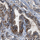 Anti-CLDN18 antibody produced in rabbit Prestige Antibodies® Powered by Atlas Antibodies, affinity isolated antibody, buffered aqueous glycerol solution