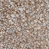 Anti-ALCAM antibody produced in rabbit Prestige Antibodies® Powered by Atlas Antibodies, affinity isolated antibody, buffered aqueous glycerol solution