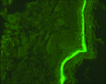 抗-整合素单克隆抗体 小鼠抗 clone SY5, ascites fluid