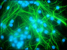 抗-神经丝200 兔抗 IgG fraction of antiserum, buffered aqueous solution