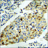 Anti-phospho-MAP3K1 (pThr1402) antibody produced in rabbit affinity isolated antibody