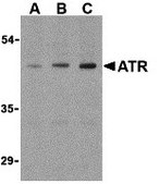 Anti-ATR antibody produced in rabbit purified antibody (Ion exchange)