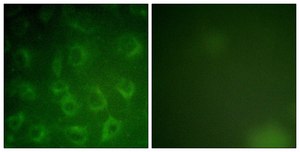 Anti-PDGFR β antibody produced in rabbit affinity isolated antibody