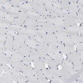 Anti-ABCB11 antibody produced in rabbit Prestige Antibodies® Powered by Atlas Antibodies, affinity isolated antibody, buffered aqueous glycerol solution