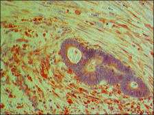Anti-PKM2 (isoform M2) antibody produced in rabbit ~1.5 mg/mL, affinity isolated antibody