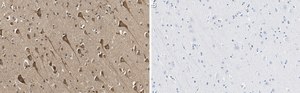 Anti-TPH-1 Antibody, clone 3J7 ZooMAb® Rabbit Monoclonal recombinant, expressed in HEK 293 cells