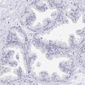 Anti-EBI3 antibody produced in rabbit Prestige Antibodies® Powered by Atlas Antibodies, affinity isolated antibody, buffered aqueous glycerol solution