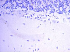 抗神经丝M（145 kDa）抗体，CT serum, Chemicon®