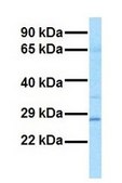Anti-GSTM1 antibody produced in rabbit affinity isolated antibody
