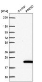 Anti-PDE6D antibody produced in rabbit Prestige Antibodies® Powered by Atlas Antibodies, affinity isolated antibody, buffered aqueous glycerol solution