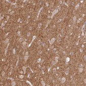 Anti-DBN1 antibody produced in rabbit Prestige Antibodies® Powered by Atlas Antibodies, affinity isolated antibody, buffered aqueous glycerol solution