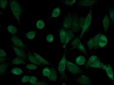 Anti-Histone Deacetylase 10 (HDAC10) antibody produced in rabbit affinity isolated antibody, buffered aqueous solution