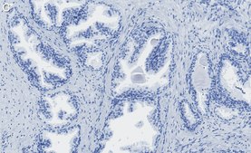 Anti-PRMT5 Antibody, clone 1H16 ZooMAb® Rabbit Monoclonal recombinant, expressed in HEK 293 cells