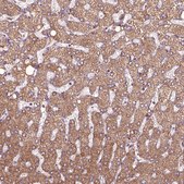 Anti-HYAL1 antibody produced in rabbit Prestige Antibodies® Powered by Atlas Antibodies, affinity isolated antibody, buffered aqueous glycerol solution