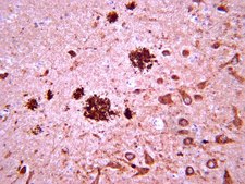 抗-淀粉样蛋白β抗体，克隆W0-2 clone WO2, from mouse