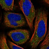 Anti-SRD5A3 antibody produced in rabbit Prestige Antibodies® Powered by Atlas Antibodies, affinity isolated antibody, buffered aqueous glycerol solution