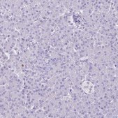 Anti-HOMER1 antibody produced in rabbit Prestige Antibodies® Powered by Atlas Antibodies, affinity isolated antibody, buffered aqueous glycerol solution