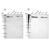 Anti-PITRM1 antibody produced in rabbit Ab1, Prestige Antibodies® Powered by Atlas Antibodies, affinity isolated antibody, buffered aqueous glycerol solution