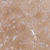 Anti-SLC6A11 antibody produced in rabbit Prestige Antibodies® Powered by Atlas Antibodies, affinity isolated antibody, buffered aqueous glycerol solution