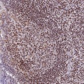 Anti-HDAC8 antibody produced in rabbit Prestige Antibodies® Powered by Atlas Antibodies, affinity isolated antibody, buffered aqueous glycerol solution