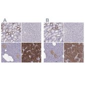 Anti-CASR antibody produced in rabbit Prestige Antibodies® Powered by Atlas Antibodies, affinity isolated antibody, buffered aqueous glycerol solution