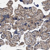 Anti-RIPK1 antibody produced in rabbit Prestige Antibodies® Powered by Atlas Antibodies, affinity isolated antibody, buffered aqueous glycerol solution