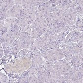 Anti-KCNH1 antibody produced in rabbit Prestige Antibodies® Powered by Atlas Antibodies, affinity isolated antibody, buffered aqueous glycerol solution