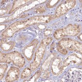 Anti-MICU2 antibody produced in rabbit Prestige Antibodies® Powered by Atlas Antibodies, affinity isolated antibody, buffered aqueous glycerol solution