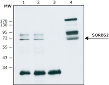 Anti-SORBS2 antibody,Mouse monoclonal clone S5C, purified from hybridoma cell culture