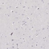 Anti-ELANE antibody produced in rabbit Prestige Antibodies® Powered by Atlas Antibodies, affinity isolated antibody