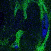 Anti-GABRA3 antibody produced in rabbit affinity isolated antibody, buffered aqueous glycerol solution