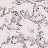 Monoclonal Anti-Nkx2-1 Antibody Produced In Mouse Prestige Antibodies® Powered by Atlas Antibodies, clone CL14531, affinity isolated antibody, buffered aqueous glycerol solution