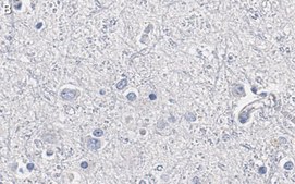 Anti-Olig2 Antibody, clone 211F1.1 ZooMAb® Mouse Monoclonal recombinant, expressed in HEK 293 cells