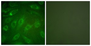 抗I型胶原蛋白抗体 兔抗 affinity isolated antibody