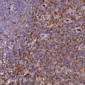 Anti-S100A4 antibody produced in rabbit Prestige Antibodies® Powered by Atlas Antibodies, affinity isolated antibody, buffered aqueous glycerol solution